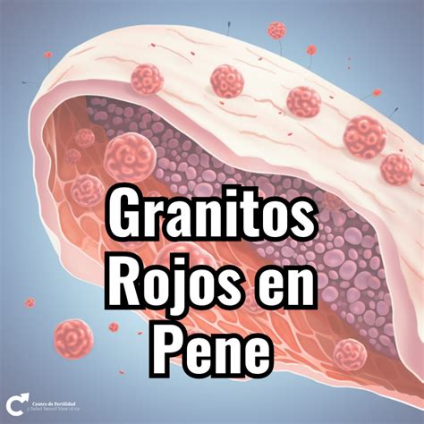 granitos en el oene|Qué puede causar granos en el pene y cómo tratarlos